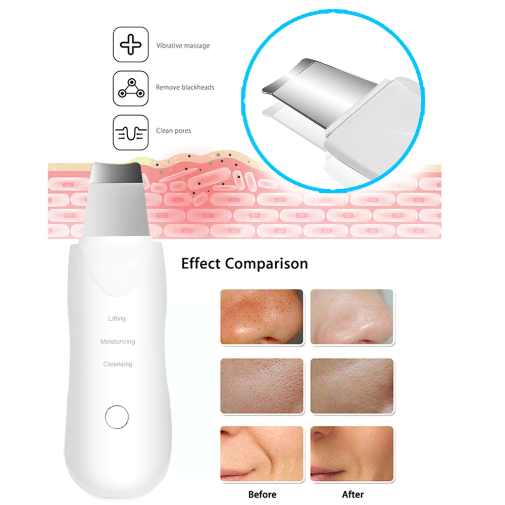 ultrasonic scrubber – nettoyage profond & soin complet du visage